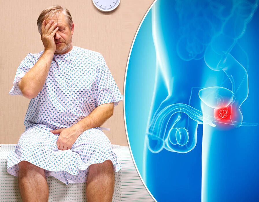 Muškarac s prostatitisom prolazi dijagnostiku bolesti