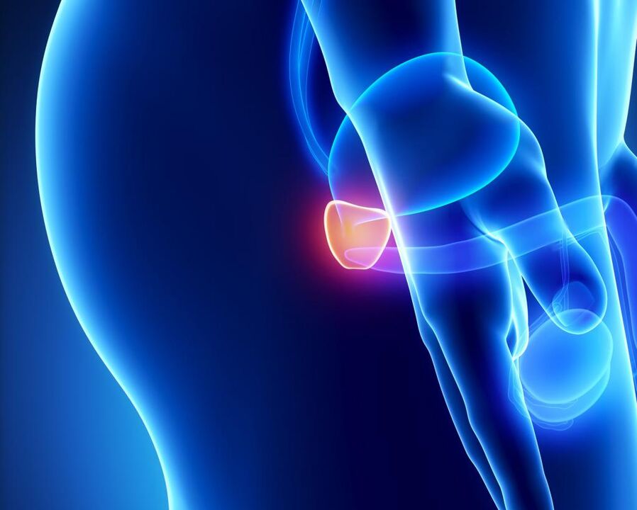 Upala prostate